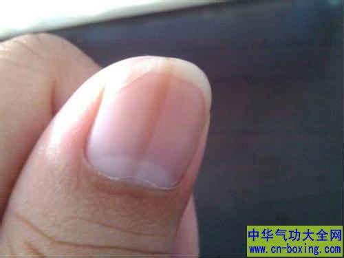 如何通过指甲检视自己的身体状况