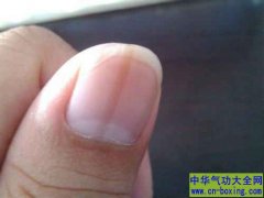 如何通过指甲检视自己的身体状况
