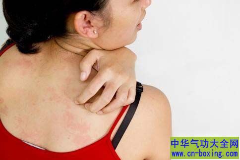 为什么看别人抓痒自己也痒?