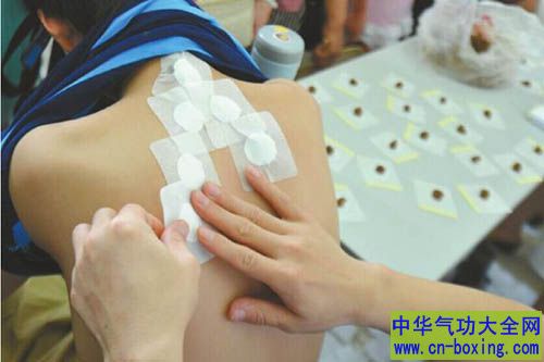 炎热三伏天贴三伏贴的好处及人群禁忌