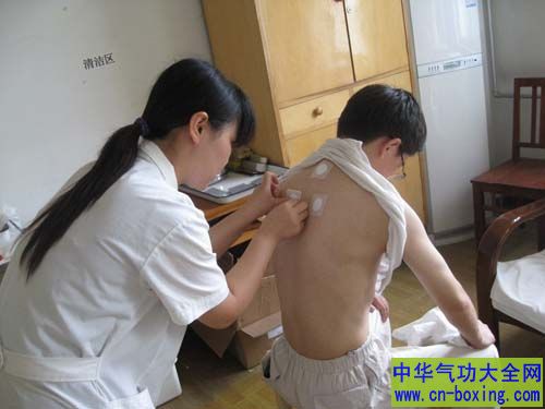 炎热三伏天贴三伏贴的好处及人群禁忌
