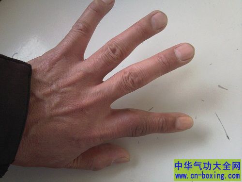 手指肿胀 可能是这六大原因