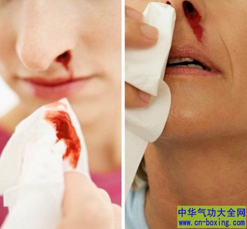 习惯性流鼻血要不要紧？两款药膳汤改善身体