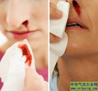习惯性流鼻血要不要紧？两款药膳汤改善身体