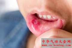 这4种小毛病不重视 恐拖成癌症
