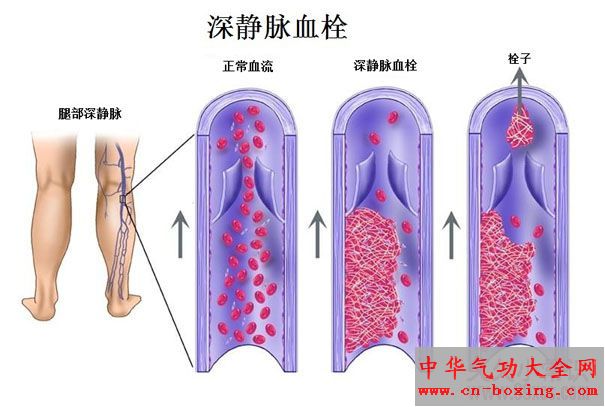 不可忽视5种重大病症前身体有预警