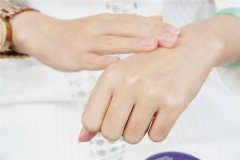 手部痣相代表什么含义解析