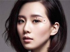 从痣相上如何看出运势？不用的位置的痣的运势