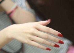 女人左手无名指上长红痣朱砂痣好吗，有什么含