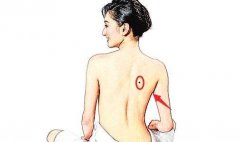 女生后背有痣图解大全，痣长在哪里好？