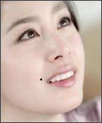 女生右嘴角有痣好吗？嘴边的痣点掉会有什么影