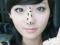 女人鼻子左边有痣好吗？聪明痣长在哪里？