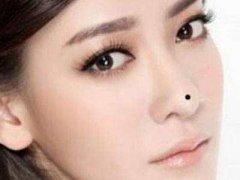 女人鼻子上有痣怎么样？破坏婚姻的痣长在哪里